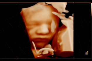 pretecho 4d scan live